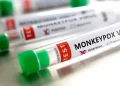 Monkeypox suspected cases rise to 141 in 13 States in Nigeria