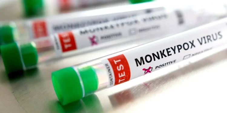 Monkeypox suspected cases rise to 141 in 13 States in Nigeria