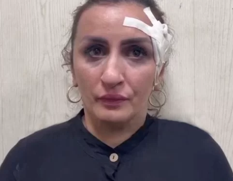 Mum accused of selling her five-day-old baby boy for £3,000 to pay for nose job