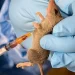 Lassa fever, Cholera kill 240, experts express worry