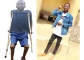 My parents not responsible for my condition – Sickle cell survivor