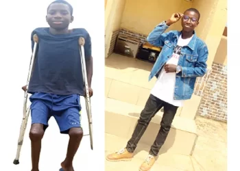 My parents not responsible for my condition – Sickle cell survivor