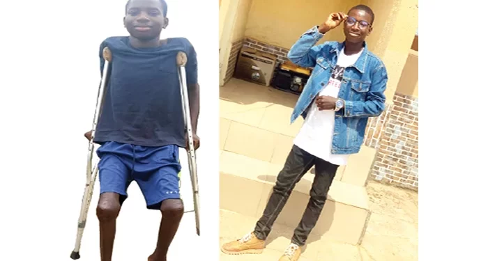 My parents not responsible for my condition – Sickle cell survivor