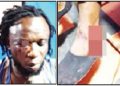 Ebonyi artiste beaten to a pulp over campaign song