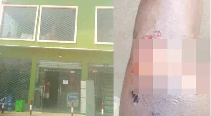 OPC members burn Osun baker over stolen money