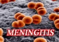 Meningitis kills 118 in 22 states — NCDC