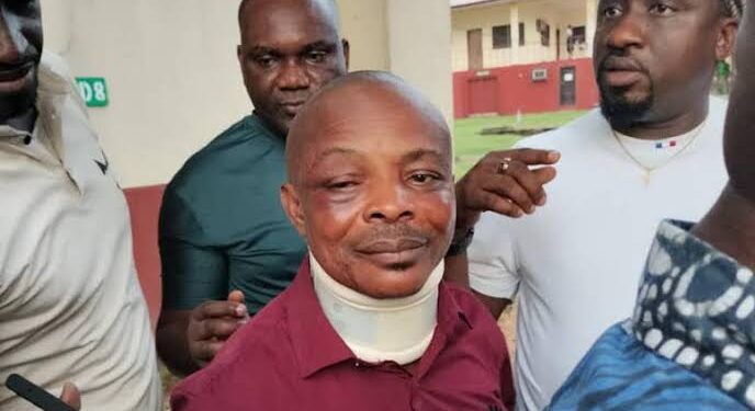 NLC President’s Arrest Sparks Outrage: Joe Ajaero’s Eyes in Peril