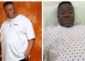 Nollywood Star Mr Ibu Undergoes Leg Amputation; Family Seeks Support”